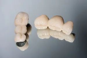 Coroanele dentare din zirconiu – estetică și durabilitate fără compromisuri