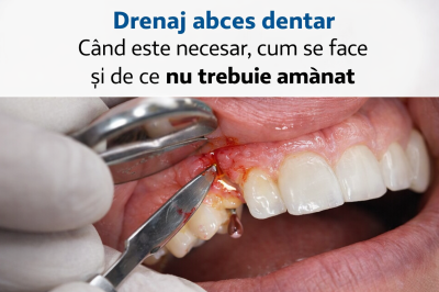 Drenaj abces dentar: când este necesar, cum se face și de ce nu trebuie amânat