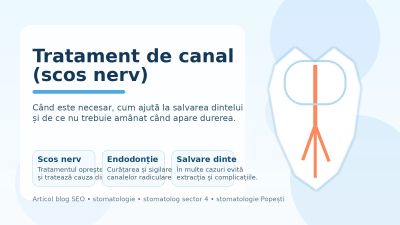 Tratament de canal (scos nerv) – când este necesar și cât costă