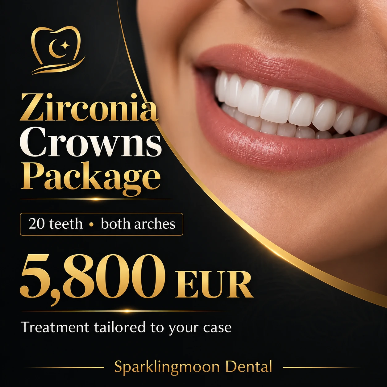Sparklingmoon Dental: 20 zirconia crowns, both arches, 5,800 EUR