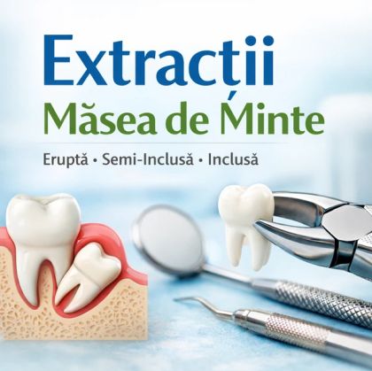 EXTRACTIE MASEA DE MINTE