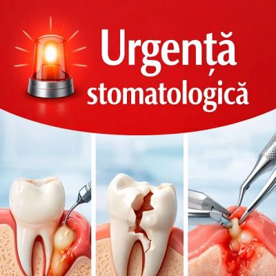 Urgență stomatologică Berceni (Sector 4) | Durere măsea, abces, drenaj | Sparklingmoon Dental
