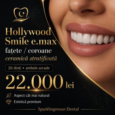 Hollywood Smile e.max premium – fațete/coroane ceramică stratificată, 20 dinți